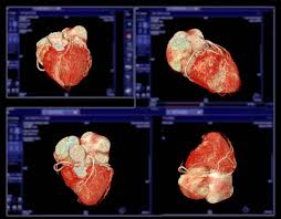 Cardiac CT, MRI & Non-Invasive Diagnostics in Amritsar